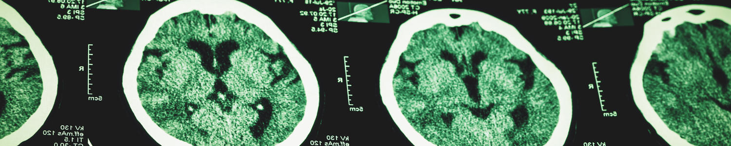 scan