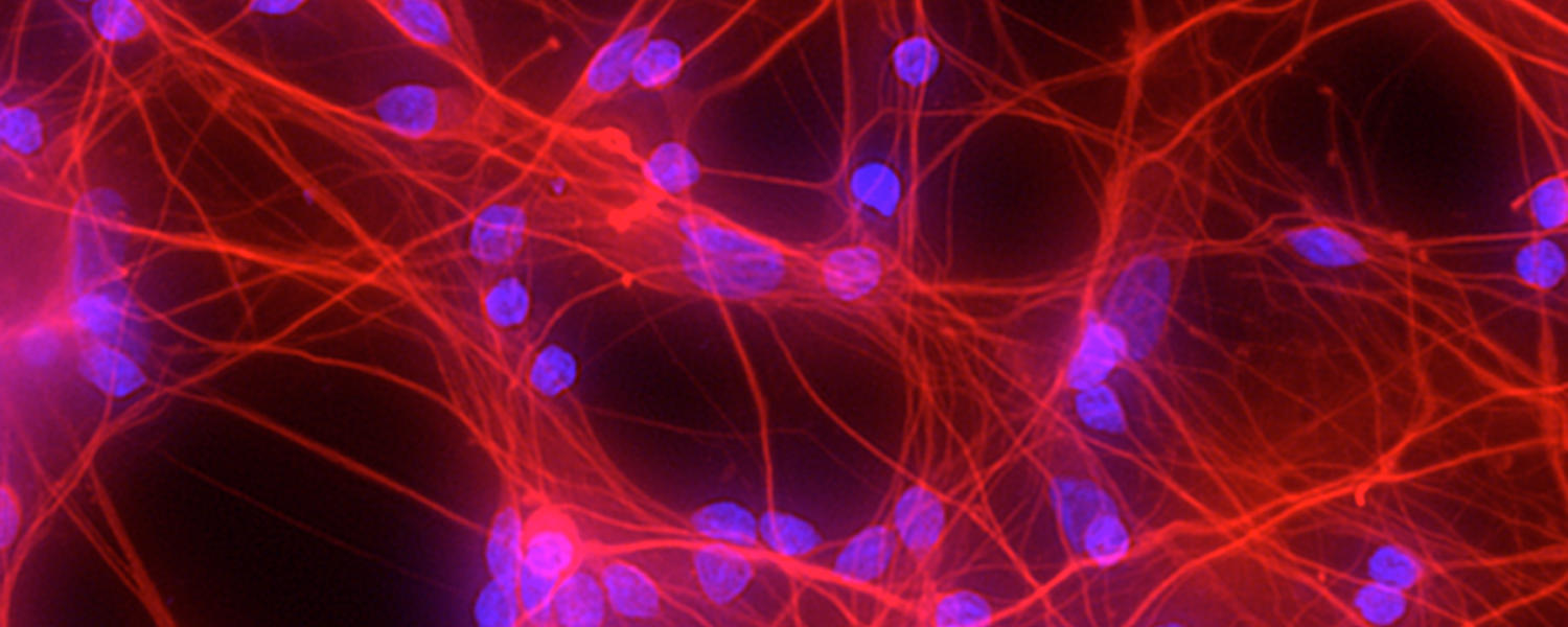 Neurons