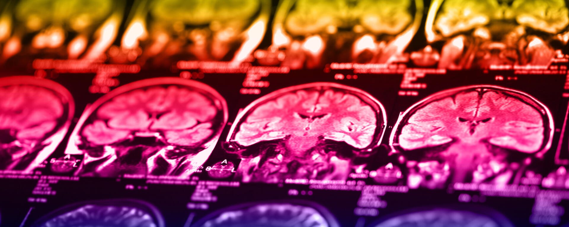 brains