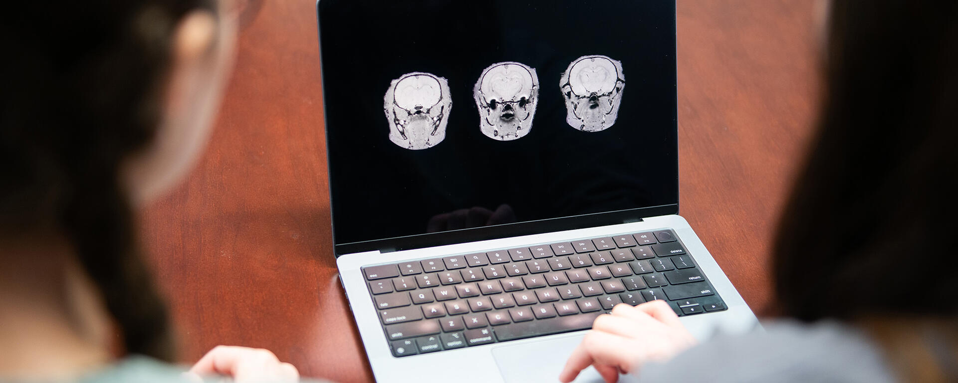 Three rodent brain MRI images are displayed horizontally on a laptop screen, which is being viewed by two women.