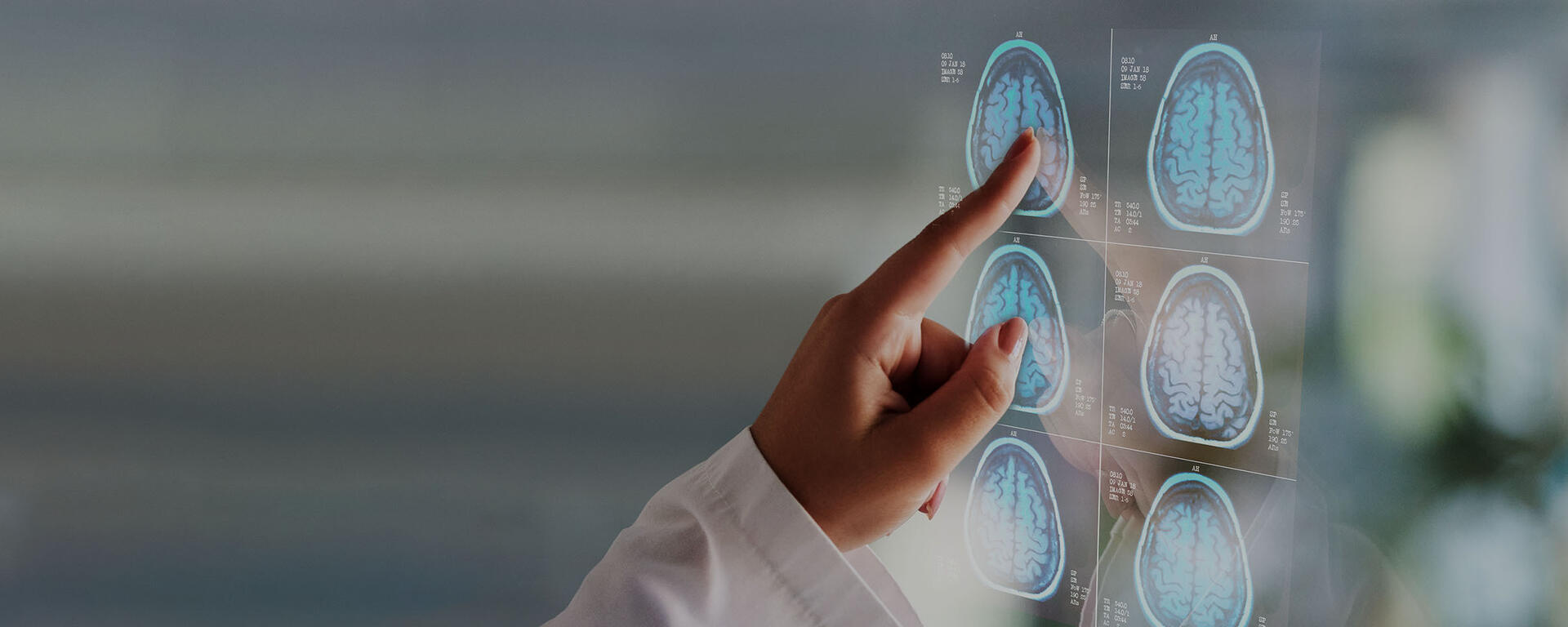 A doctor points to brain scan images.