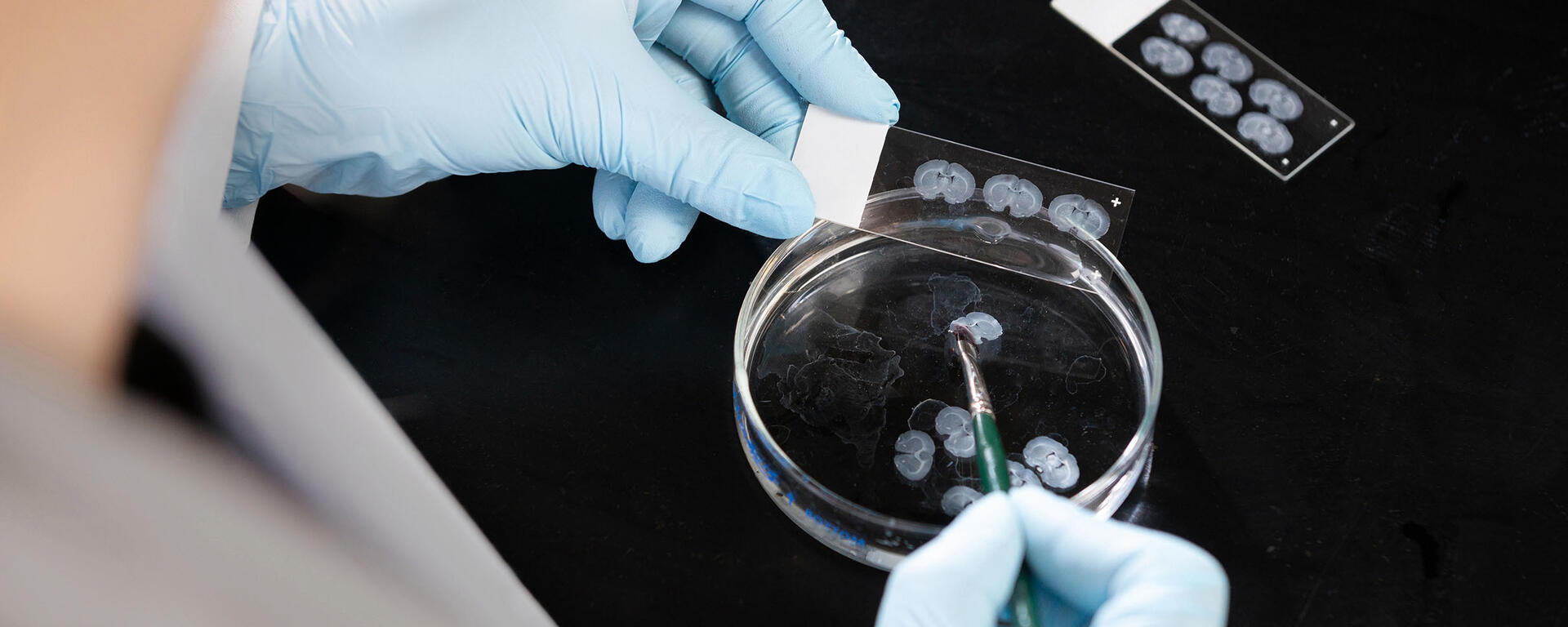 Close up of researcher transferring rodent brain slices from a Petri dish to slides.