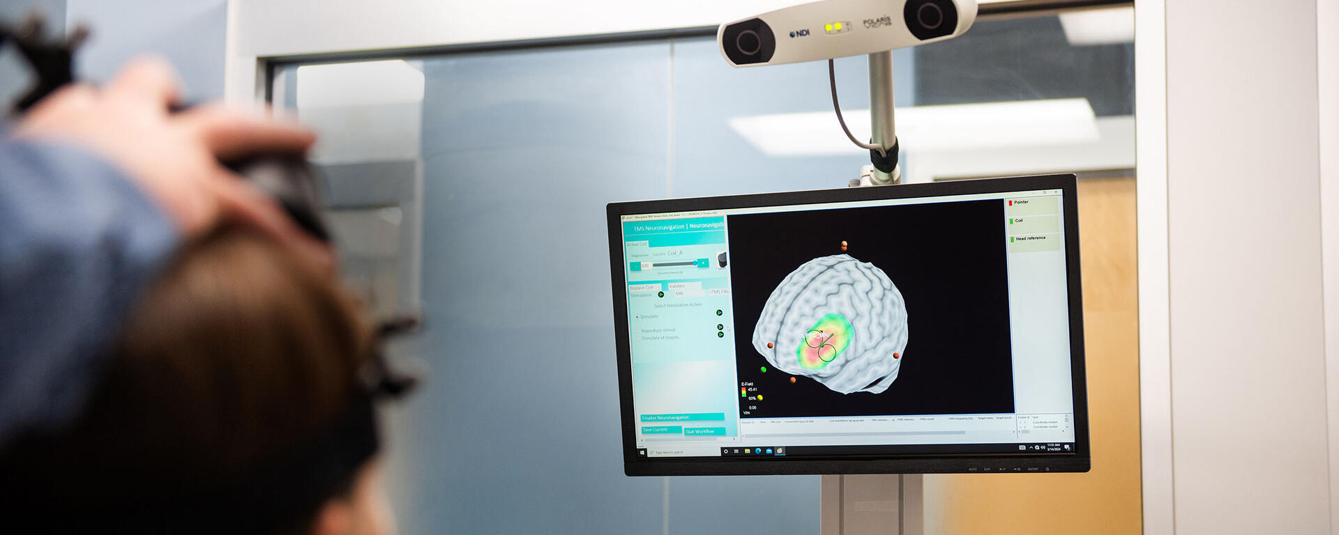 Dr. Alex McGirr demonstrates transcranial magnetic stimulation (TMS) on his graduate student, showing a depiction of her brain on a monitor.