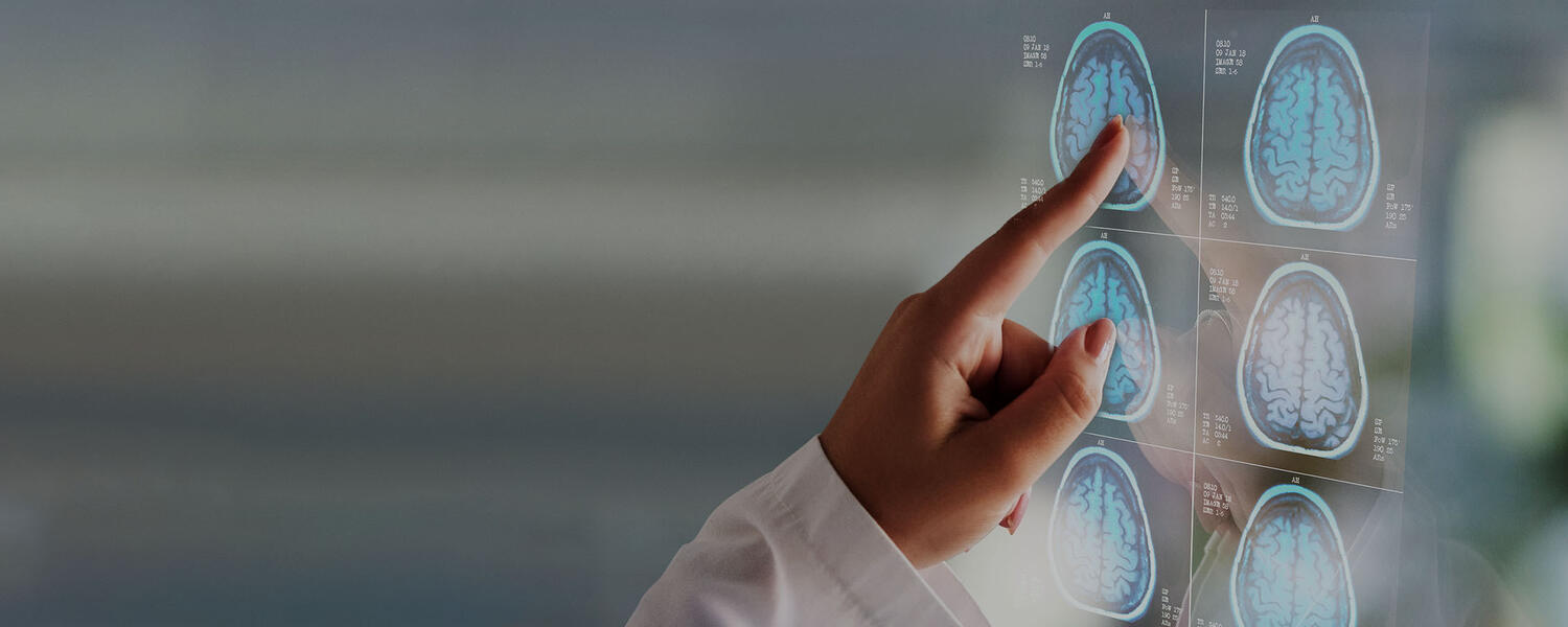 A doctor points to brain scan images.