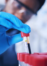 blood test