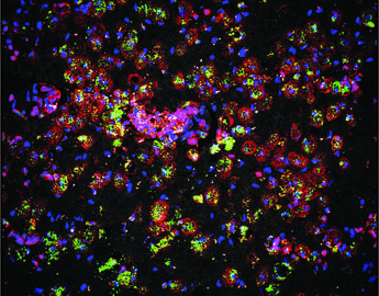 microglia