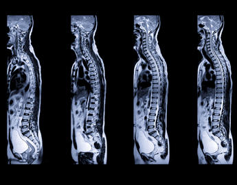 xray